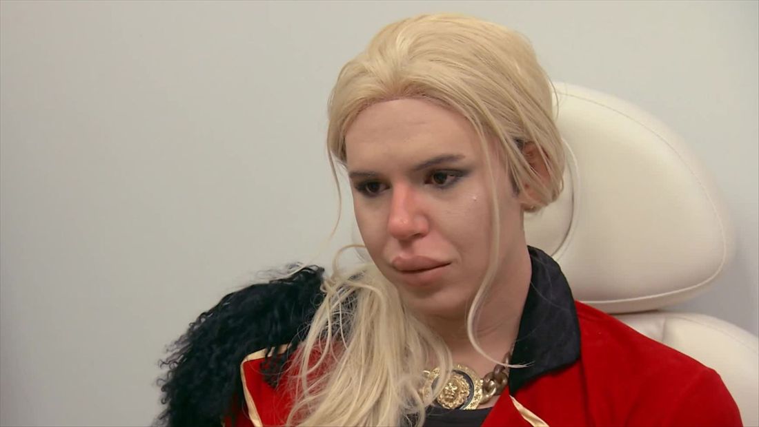 "Botched" Recap: 417 "Botched" Recap: 417